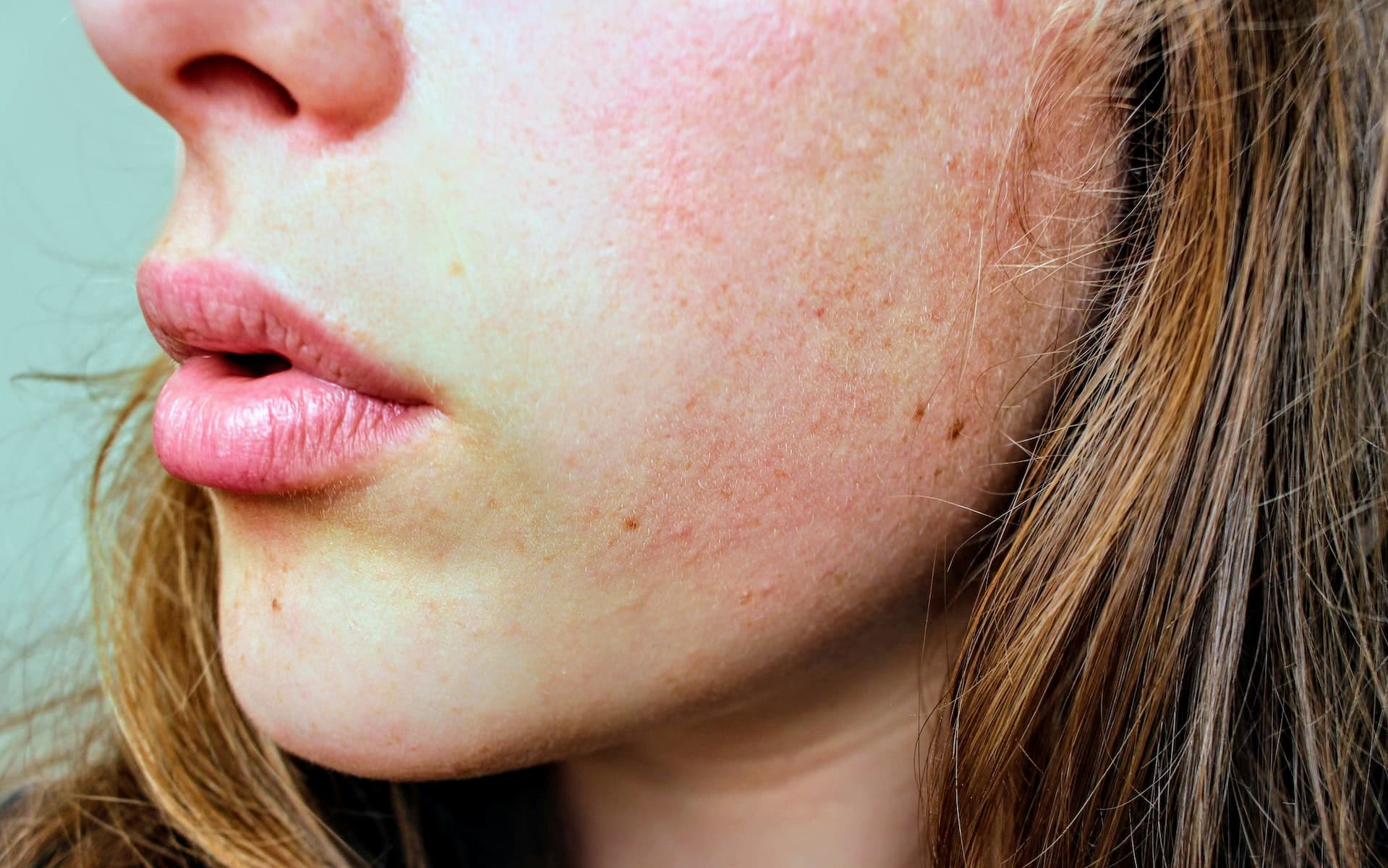 Comment ne plus avoir la peau grasse ?